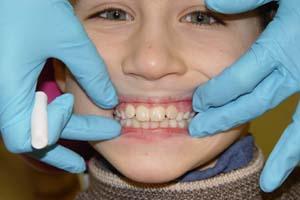 Минимальное участие стоматолога